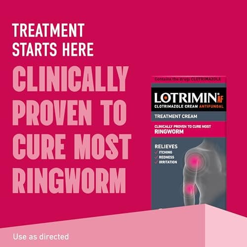 Lotrimin AF Ringworm Cream Clotrimazole 1% - Clinically Proven Effective Antifungal Cream Treatment of Most Ringworm, For Adults and Kids Over 2 years, .42 Ounce (12 Grams)