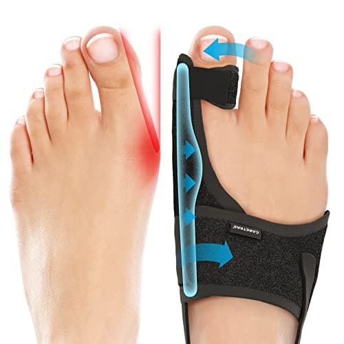 Caretras Bunion Corrector Review: Does It Actually Work?