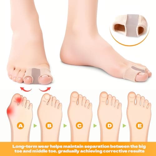 LeaOcaao 4 PCS Gel Bunion Toe Separators with 2 Loops for Overlapping Toes Gel Toe Spacers Bunion Corrector for Feet, Hammer Toe Straightene for Women Men