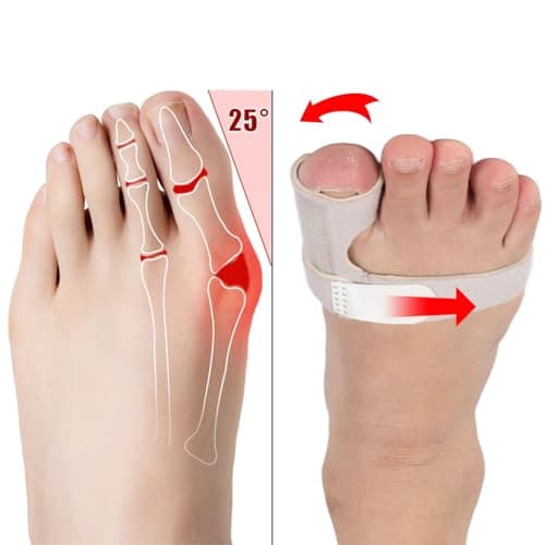 Joyzan Toe Brace Splint, Adjustable Orthopedic Corrector Big Toe Fracture Fixator Straightener Valgus Hammer Correction Protector Separator Sleeve Support Joint Men Women