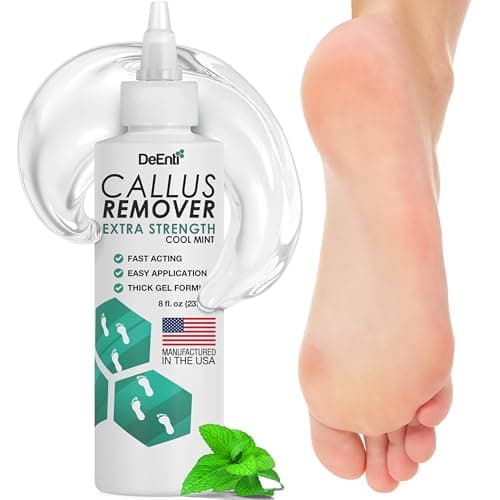 DeEnti Callus Remover: Recensione Onesta del Gel Rimuovi Calli