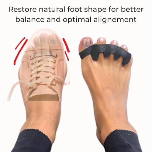 The Toe Spacer from Spacer Mobility, Recovery from the Ground Up, Correct Bunions, Plantar Fasciitis, & Correct Toes | Unisex Therapeutic Toe Spacer - Relieve Foot Pain and Tension | 4-Loop (4-Loop)