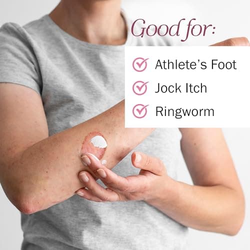 TenderGentle Clotrimazole Antifungal Cream for Skin - 1 Pack with 4 oz. of Clotrimazole Cream for Jock Itch, Athletes Foot Treatment, and More