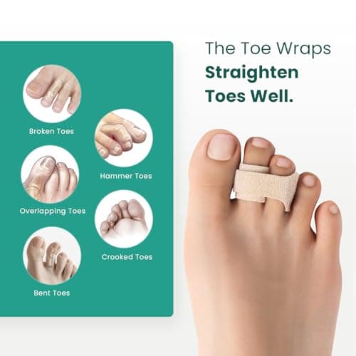Welnove Hammer Toe Straightener - 8 Pack Broken Toe Wraps - Hammer Toe Corrector for Women - Toe Splints for Crooked Toes, Curled Toes, Bent Toes - (Large, Beige)