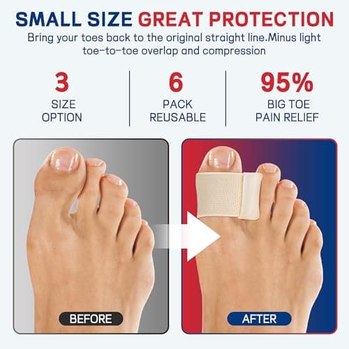 FULEEAN Big Toe Spacers,Hallux Valgus Corrector,Relieve Bunion Pain,Prevent Overlapping Toes, All-Day Comfort for Men & Women, Fits in Shoes.