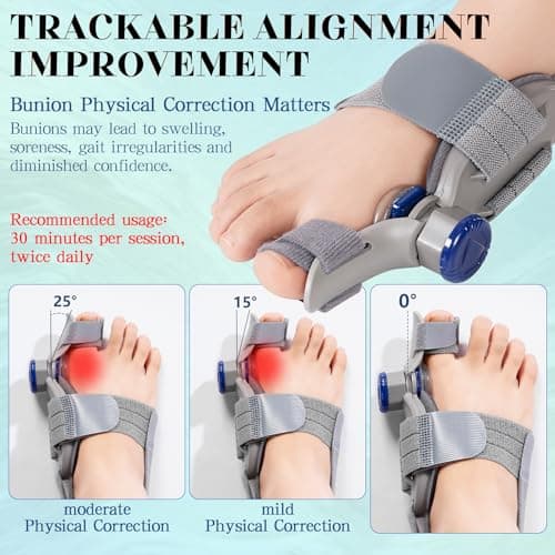 New Upgrade Treatmedy Bunion Corrector for Women & Men, Adjustable Bunion Fix Splint with Silicone Pad - Big Toe Straightener for Hallux Valgus Pain Relief, Fits Left/Right Feet (Day & Night Wear)