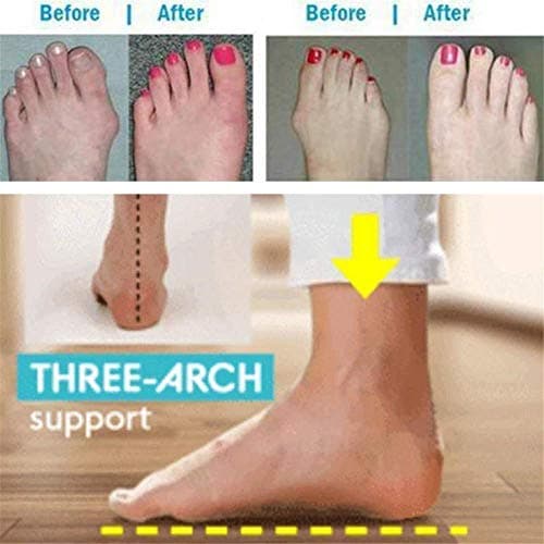 Orthopedic Bunion Corrector Sandals,Comfy Platform Flat Sole PU Leather Shoes for Women (Khaki,8)