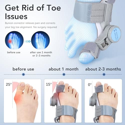 VEVARUN Bunion Corrector for Women Men: Big Toe Straightener Bunion Fix with Adjustable Knob-Orthopedic Bunions Splint Brace Toe Alignment Correction for Hallux Valgus Pain Relief Day/Night 1PCS (Grey)