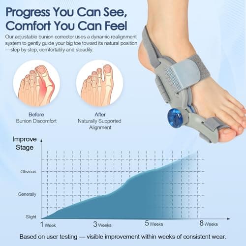 Bunion Corrector for Women Men Big Toe,Adjustable Knob Bunion Corrector for Bunion Relief,Bunion Fix with Bunion Silicone Pad,Suitable for Left and Right Feet(1PCS)