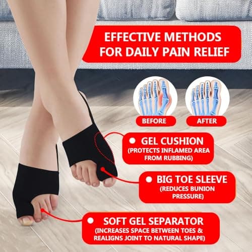 ZXCFBEA 2PCS Bunion Corrector for Women & Men,Big Toe Separators-Bunion Splint-Bunion Pads-Hammer Toes Straightener-Toes Spacers Pain Relief, Comfortable & Breathable for Day/Night