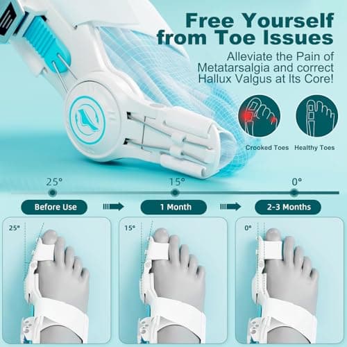 Kutain Upgraded Bunion Corrector for Women & Men, Orthopedic Bunions Correction with Non Slip Big Toe Separators, Adjustable Bunion Splint Suitable for Left/Right Feet Bunion Relief (1PCS)