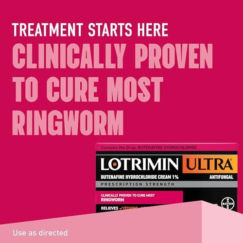 Lotrimin Ultra Ringworm Cream, Butenafine Hydrochloride 1%, Effective Antifungal Treatment of Most Ringworm, 1.1 Ounce (30 Grams)