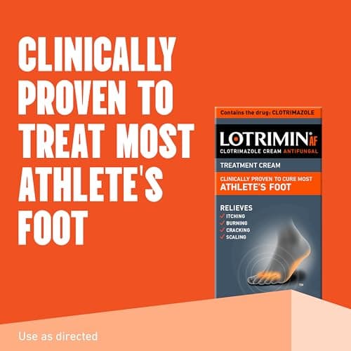 Lotrimin® AF Cream, Athlete's Foot 1% Clotrimazole Antifungal Cream Treatment, Clinically Proven Effective, 1.1 Ounce (New Look)