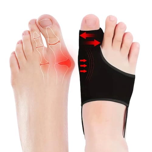 ZXCFBEA Bunion Corrector Review – Real Test Results
