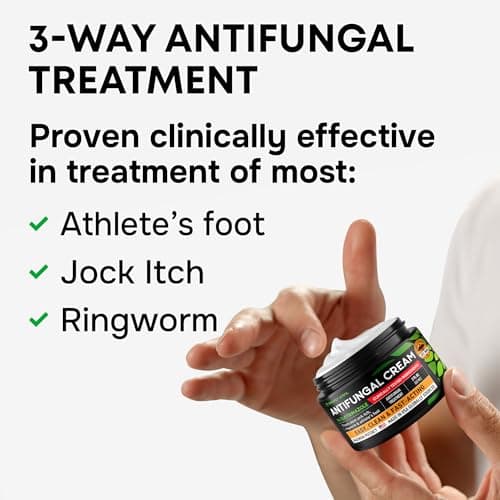 SimplyVital 1% Clotrimazole Antifungal Cream - Treats Most Athlete’s Foot, Jock Itch, Ringworm - Athletes Foot Treatment, Anti Fungal Cream for Skin, Ring Worm Medication for Humans, 2 oz