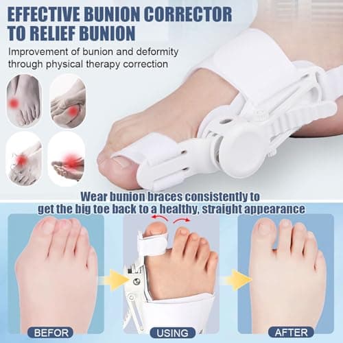 Bunion Corrector for Women & Men - Adjustable Nighttime Big Toe Straightener Bunions Splint with ABS Support for Hallux Valgus Relief Hammer Toe Brace Sleeping Home Use Left/Right Feet - 2PC Black