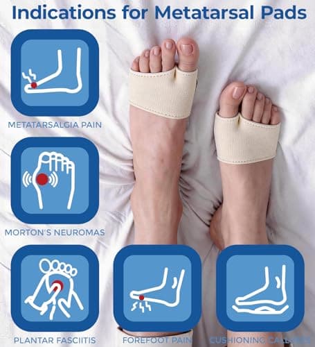 MasterMo Metatarsal Pads for Men and Women - Ball of Foot Pain Relief Cushions for Sesamoiditis, Metatarsalgia, Morton's Neuroma - 2 Pairs Fabric Sleeves with Gel Inserts (Beige, M)