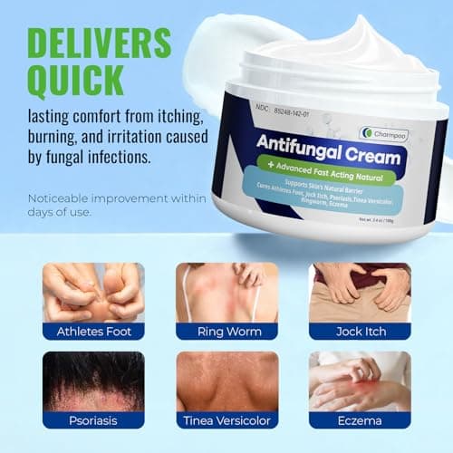 CHARMPOO Antifungal Cream for Jock Itch: 2% Miconazole and Herbal Formula for Itchy Skin Relief Extra Strength - Cures Ringworm Athletes Foot Tinea Versicolor 100g